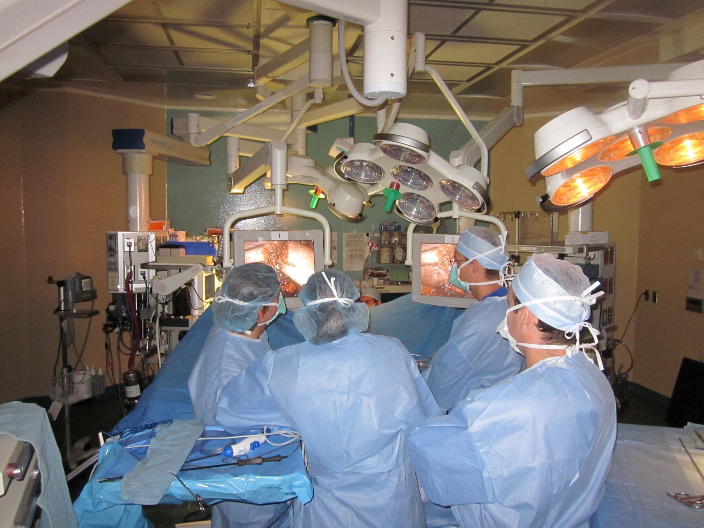 Quirófano con lámparas quirúrgicas y monitores durante una cirugía abdominal